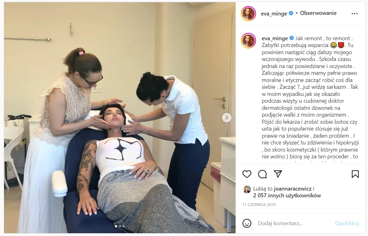 Ewa Minge poprawia urodę