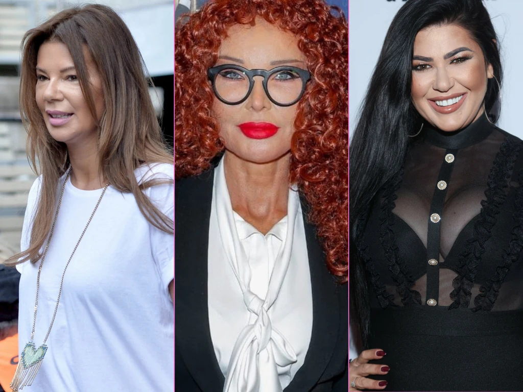 Gwiazdy, które przesadziły z botoksem