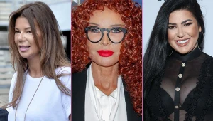 Gwiazdy, które przesadziły z botoksem