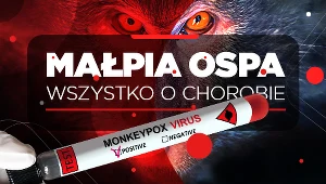 Małpia ospa. Wszystko o chorobie
