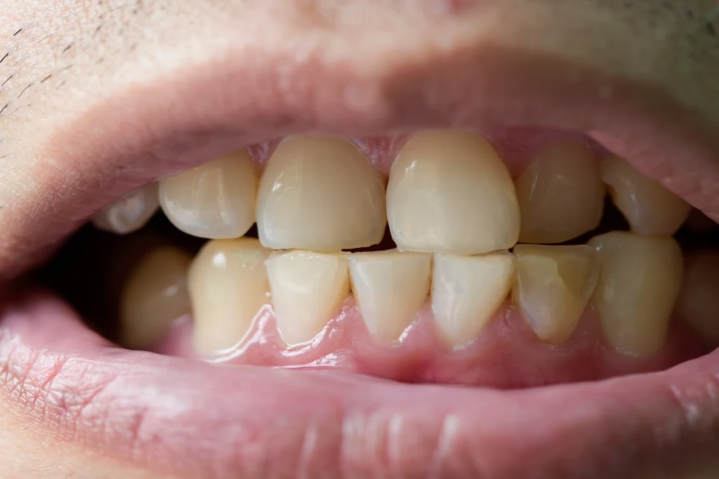 Zęby można wybielić domowym sposobem