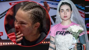 "Zusje" przegrała z "Lil Masti", a po walce trafiła do szpitala