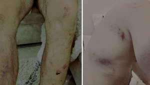 Zdjęcia pobitych żołnierzy opublikował doradca Cichanouskiej