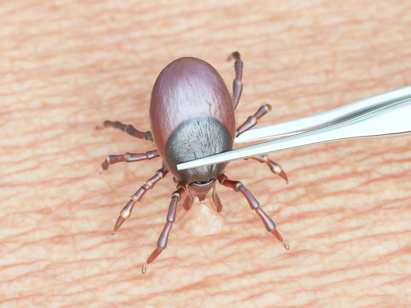 Kleszcza trzeba usunąć jak najszybciej. Sprawdź, czego potrzebujesz i jak zrobić to poprawnie Kleszcza trzeba usunąć jak najszybciej. Sprawdź, czego potrzebujesz i jak zrobić to poprawnie