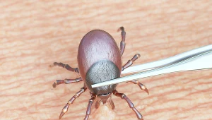 Kleszcza trzeba usunąć jak najszybciej. Sprawdź, czego potrzebujesz i jak zrobić to poprawnie