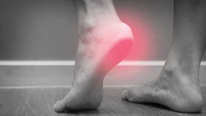 Najskuteczniejszym sposobem leczenia ostróg piętowych jest operacja 