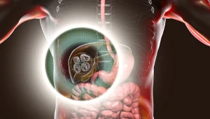 Pasożyt zagnieżdżają się w ważnych organach. Uszkadzają mózg, płuca i kości