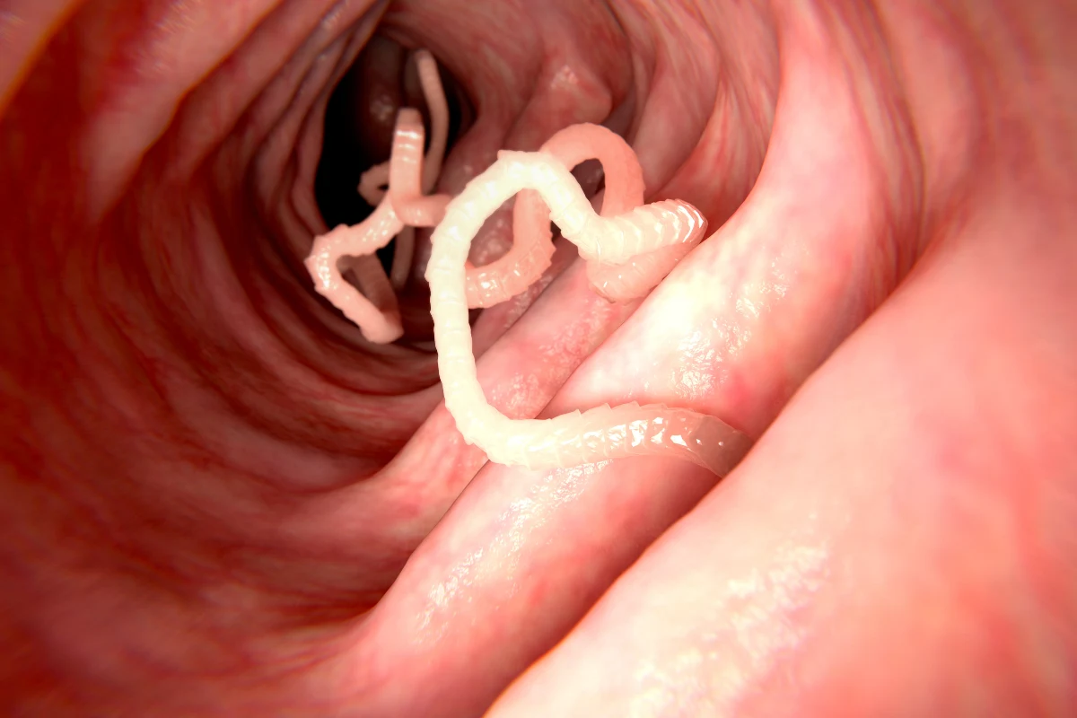 Tasiemiec z jelit przedostaje się do innych narządów w organizmie człowieka: płuc, mózgu, a nawet kości