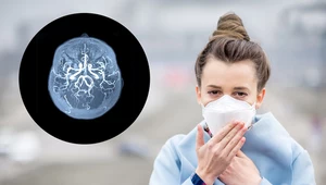 Cząsteczki smogu wędrują z płuc do mózgu człowieka