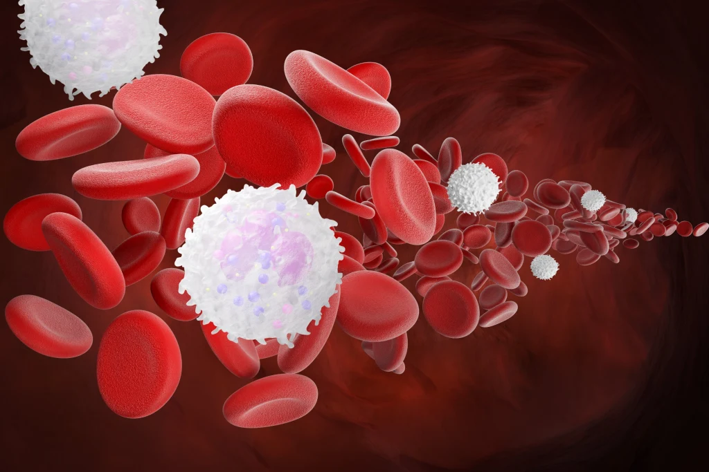 Leukocytoza może być stanem fizjologicznym lub oznaczać poważną chorobę szpiku kostnego Leukocytoza może być stanem fizjologicznym lub oznaczać poważną chorobę szpiku kostnego