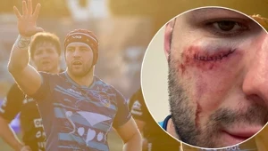 Piotr Zeszutek z Ogniwa Sopot odniósł kontuzję w finale Ekstraligi rugby