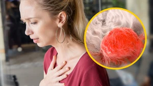 Ten rak rozwija się latami. Objawy przypominają refluks lub zgagę