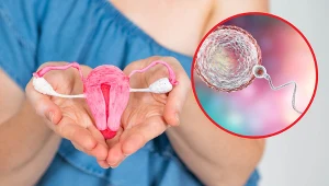 Ciąże ektopowe często ulegają samoistnemu poronieniu