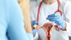  Laparoskopowa plastyka jajowodów pozwala udrożnić narząd za pomocą cienkiego endoskopu