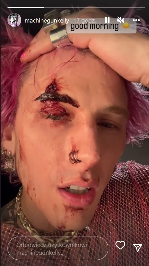 Machine Gun Kelly z zakrwawioną twarzą @machinegunkelly/ Machine Gun Kelly z zakrwawioną twarzą @machinegunkelly/