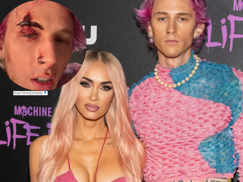 Machine Gun Kelly z zakrwawioną twarzą @machinegunkelly/