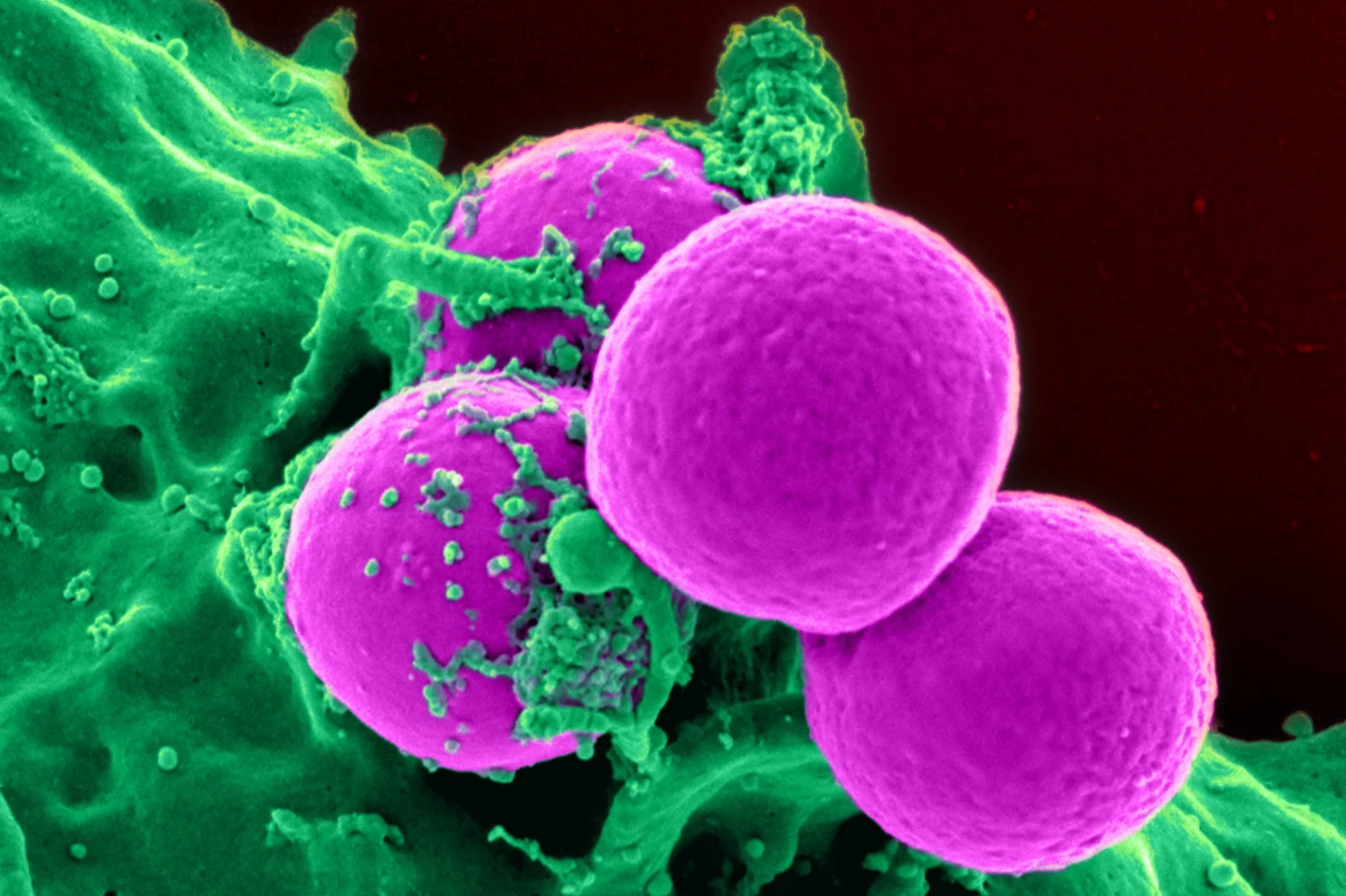 Groźny szczep MRSA może przenosić się na ludzi Groźny szczep MRSA może przenosić się na ludzi