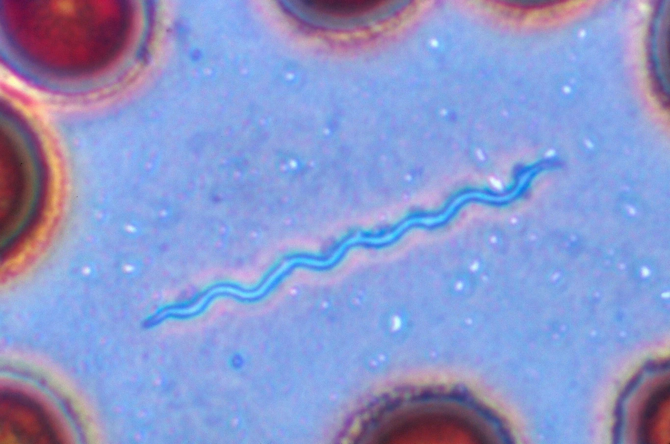 Bakteria wywołująca boreliozę - Borrelia burgdorferi pod mikroskopem