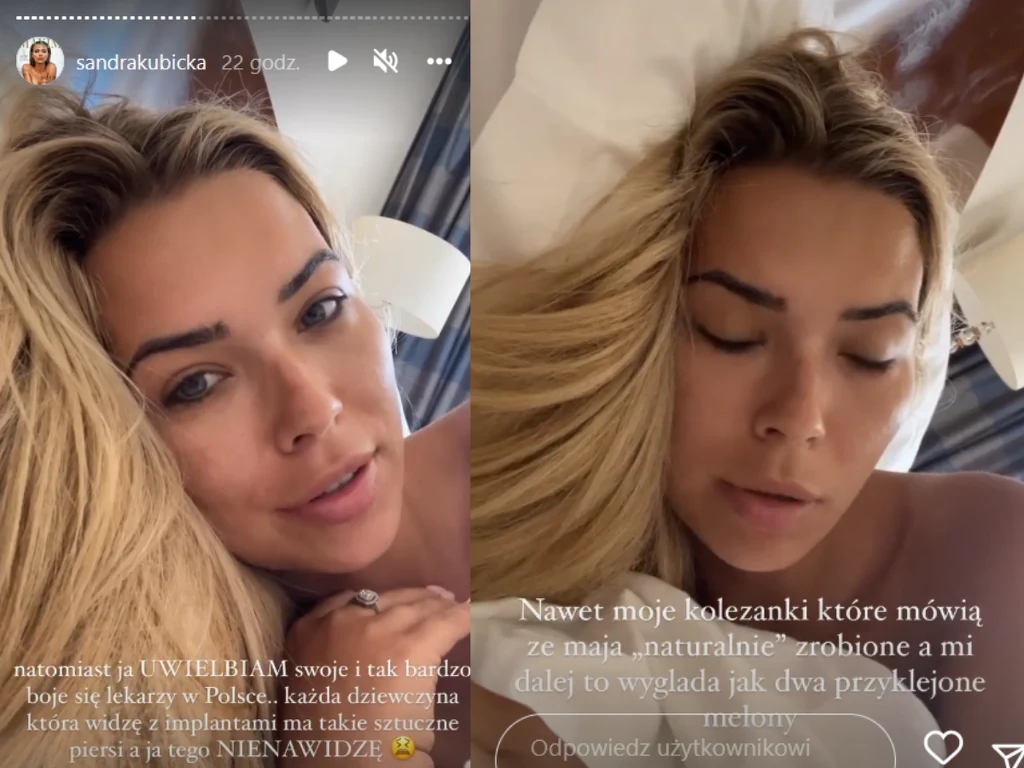 Sandra Kubicka musi wymienić implanty w piersiach @sandrakubicka/