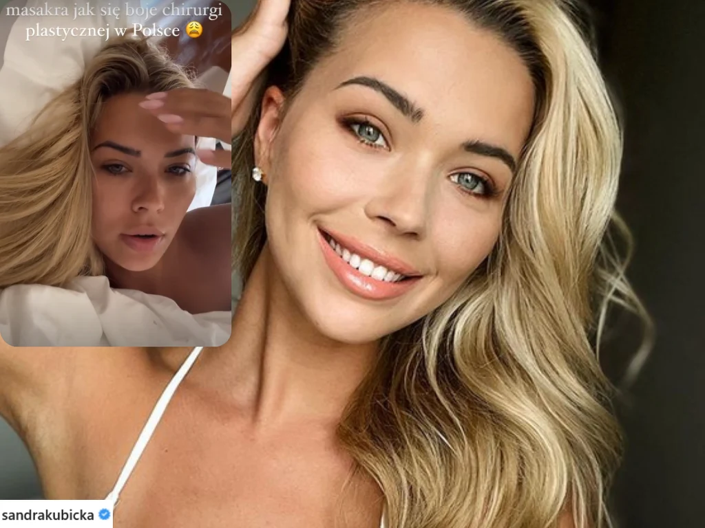 Sandra Kubicka musi wymienić implanty w piersiach @sandrakubicka/