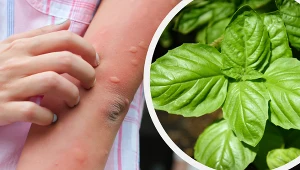 Co warto zastosować na ugryzienie komara? Te domowe sposoby są polecane