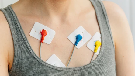 Sztuczna inteligencja wyłapuje choroby serca z EKG. Potrzebuje zaledwie kilku sekund