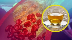 W zapobieganiu miażdżycy tętnic najważniejsza jest profilaktyka, czyli prawidłowa dieta i zdrowy styl życia