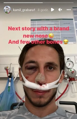 Kamil Grabara po fatalnym zderzeniu Kamil Grabara po fatalnym zderzeniu