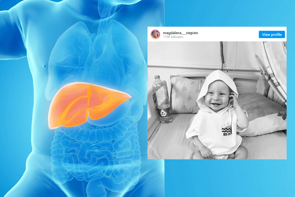 Guz rabdoidalny wątroby bardzo szybko daje przerzuty do odległych narządów /instagram.com/magdalena___stepien/