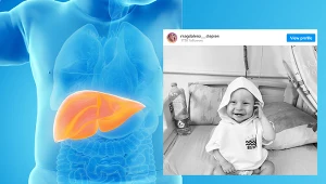 Guz rabdoidalny wątroby bardzo szybko daje przerzuty do odległych narządów /instagram.com/magdalena___stepien/