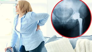 Po dwóch godzinach mają staw jak nowy. Coraz więcej osób się decyduje