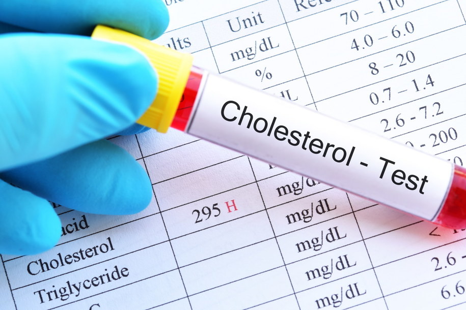 Test na poziom cholesterolu