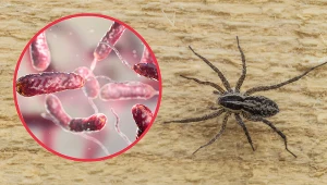 Pająki pozostawiły na ciele kobiety aż 15 ukąszeń i zaraziły mięsożerną bakterią, która wywołuje martwicę skóry