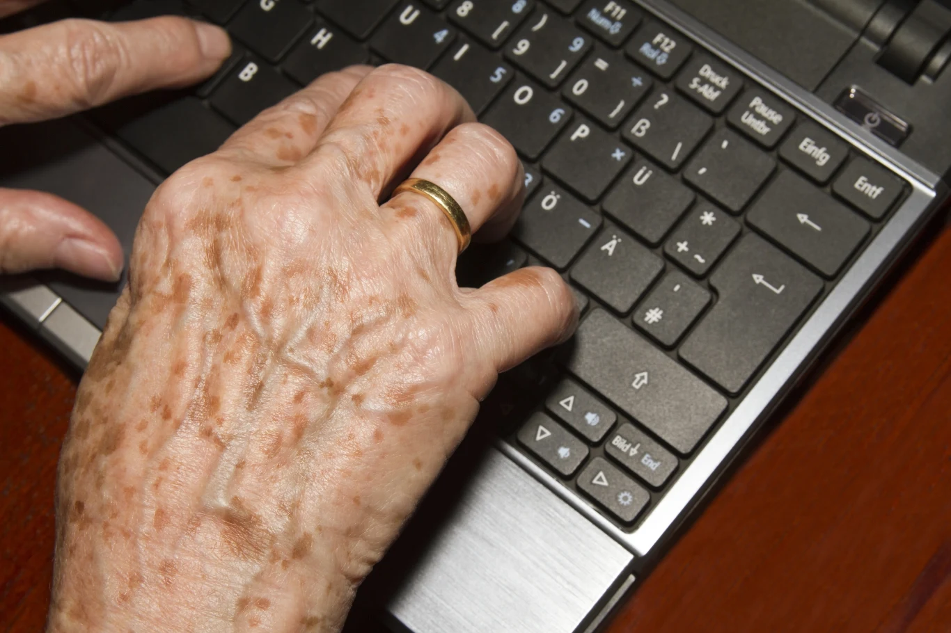 Jednym z domowych sposobów na plamy starcze jest aloes. 