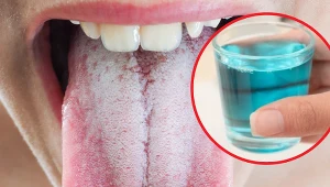 Aby płyn do jamy ustnej przyniósł efekt, należy pamiętać o podstawowych zasadach stosowania go