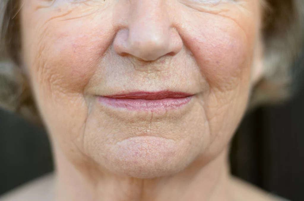 Wraz z wiekiem skóra traci jędrność i elastyczność