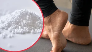 Okład z mocznika pozwala nawilżyć zrogowaciały naskórek na stopach, pozbyć się odcisków i nagniotków