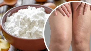 Mąka ziemniaczana może pomóc na otarcia i odparzenia 