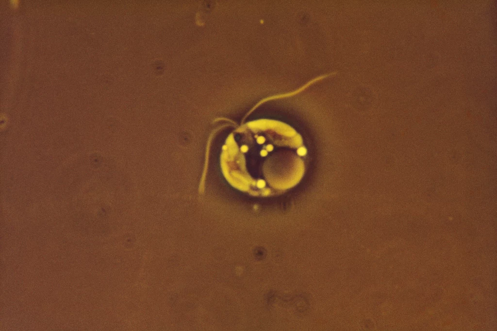 Algi gatunku  Prymnesium parvum pod mikroskopem