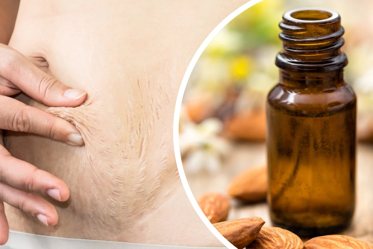 Olejek migdałowy regularnie wcierany w skórę sprawia, że staje się ona nawilżona i sprężysta