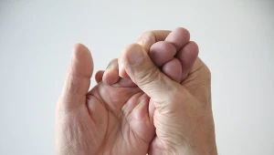 Drętwienia rąk mogą być spowodowane zespołem cieśni nadgarstka lub być pierwszym objawem zwiastującym udar mózgu