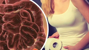 Uczucie silnego parcia na stolec występuje nie tylko w przypadku raka jelita grubego, ale towarzyszy też innym chorobom