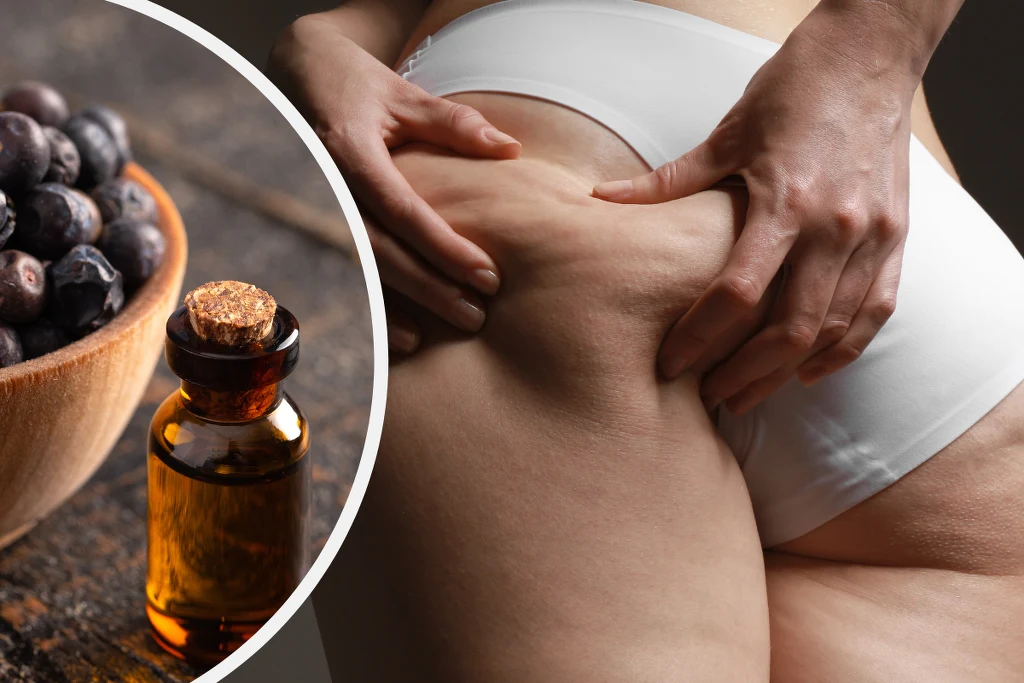 Olejek jałowcowy pomaga spłycić rozstępy oraz likwidować cellulit