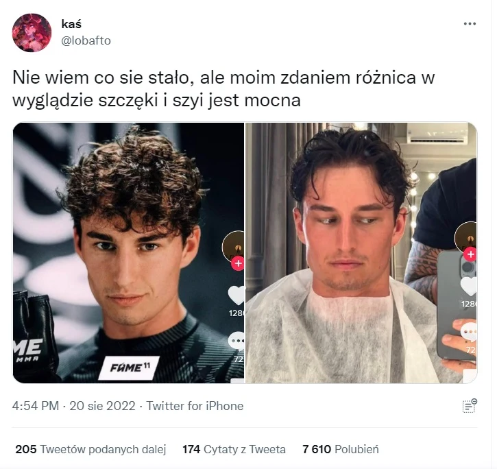 Marcin Dubiel i jego zmieniona szczęka Marcin Dubiel i jego zmieniona szczęka