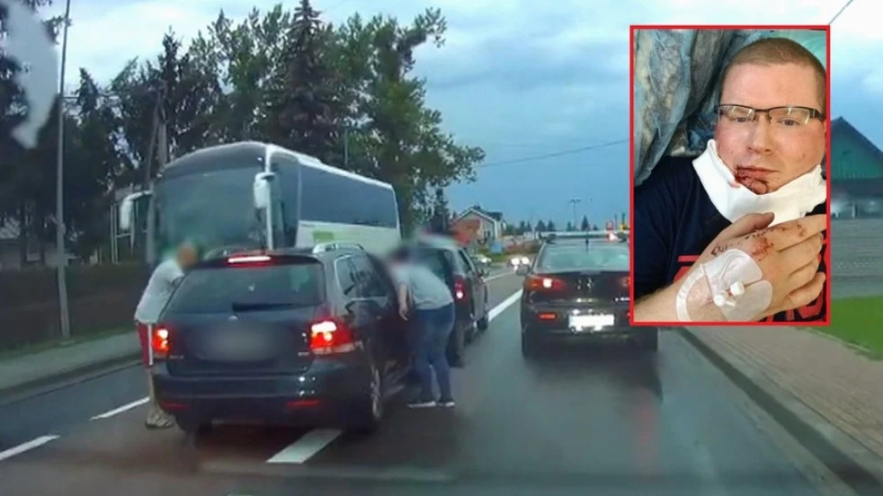 Kierowca i pasażerka Skody z nieznanych przyczyn zaatakowali niepełnosprawnego kierującego Kierowca i pasażerka Skody z nieznanych przyczyn zaatakowali niepełnosprawnego kierującego