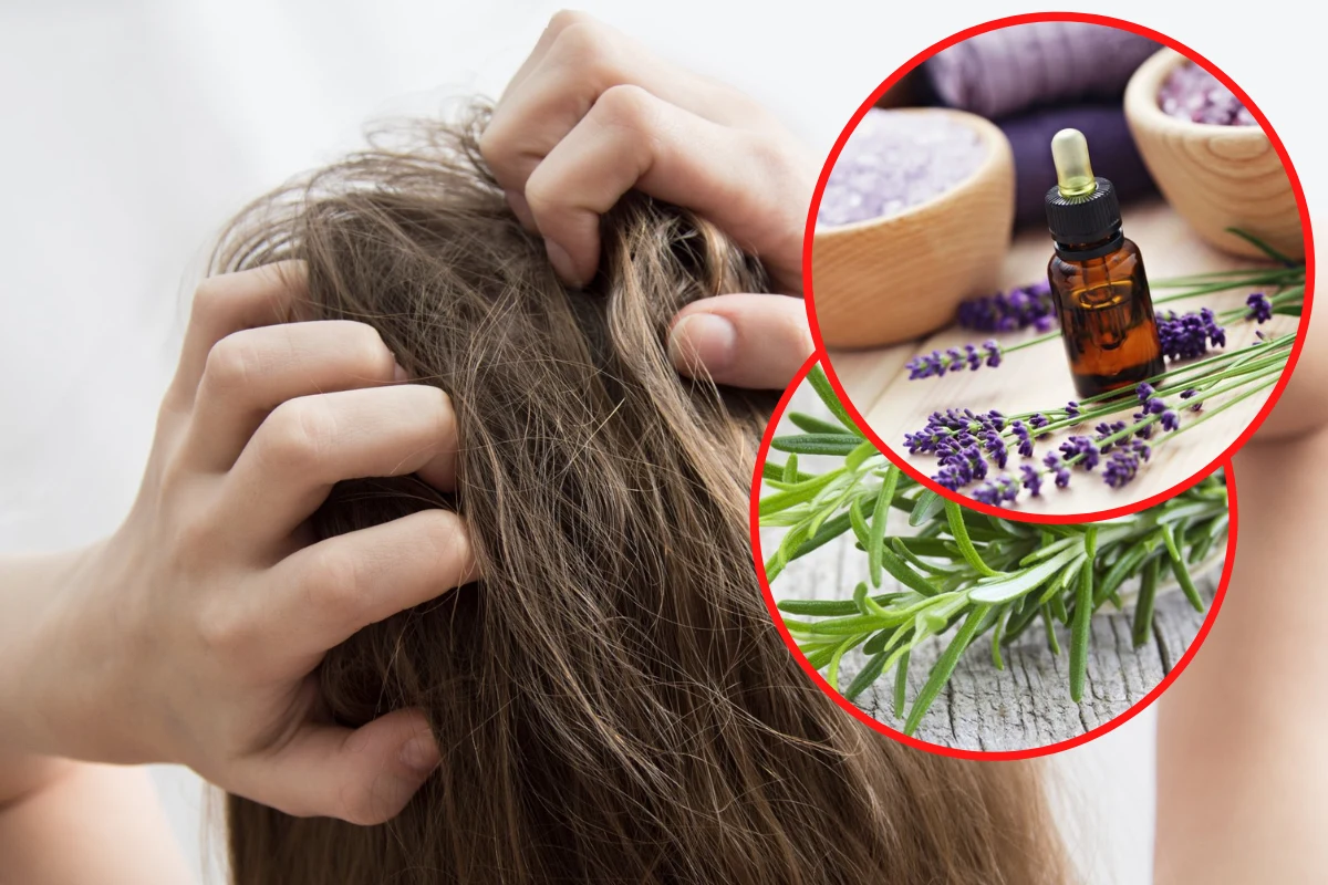 W domowej walce z wszami niezastąpiony jest ocet, a także olejki eteryczne, które odstraszają pasożyty