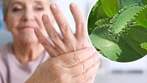 Sok z żyworódki likwiduje bóle stawów w chorobach reumatycznych, a także pomaga w przypadku silnego bólu głowy