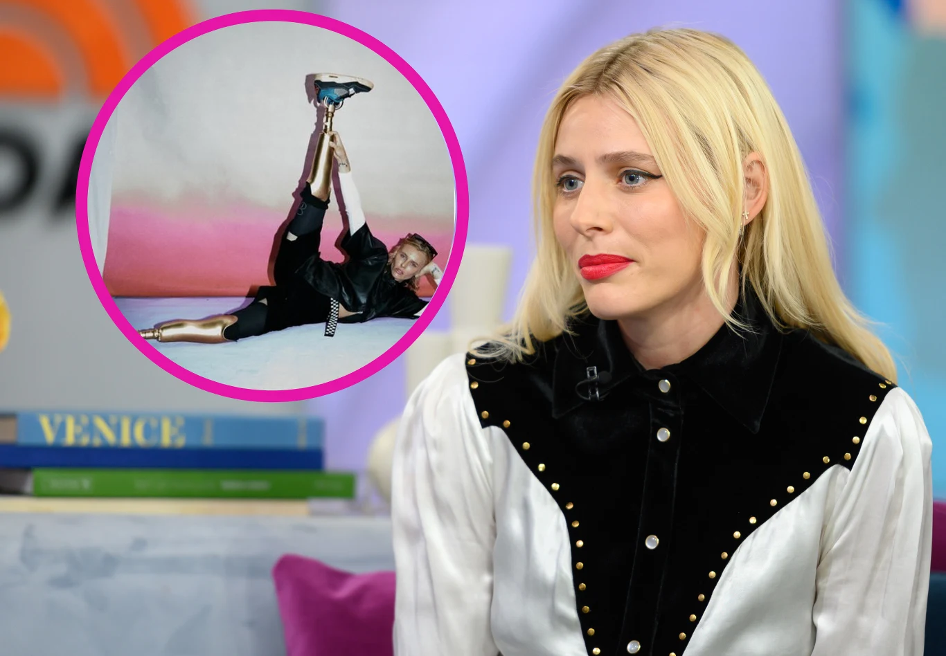 Lauren Wasser straciła nogi w wyniku wstrząsu spowodowanego nieprawidłowym używaniem tamponów Lauren Wasser straciła nogi w wyniku wstrząsu spowodowanego nieprawidłowym używaniem tamponów