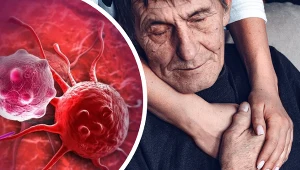 Do nowotworów o najgorszym rokowaniu zalicza się: raka jelita grubego, raka płuc, raka żołądka i raka trzustki