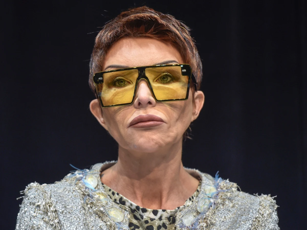 Ewa Minge mówi, co się stało z jej twarzą: "Wyglądałam jak monstrum" Ewa Minge mówi, co się stało z jej twarzą: "Wyglądałam jak monstrum"